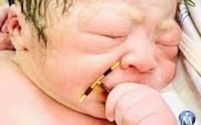 Bebé con DIU en la mano es un triunfo de la vida, dice experta